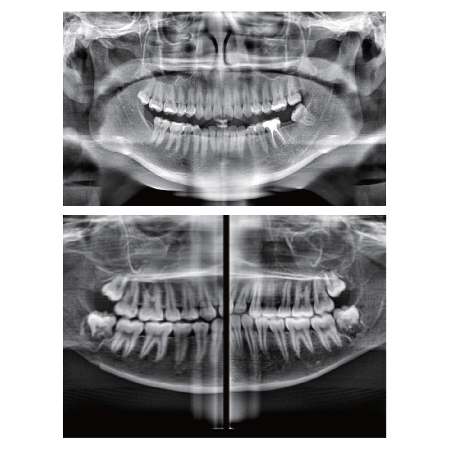Prexion | 3D Expedition CBCT