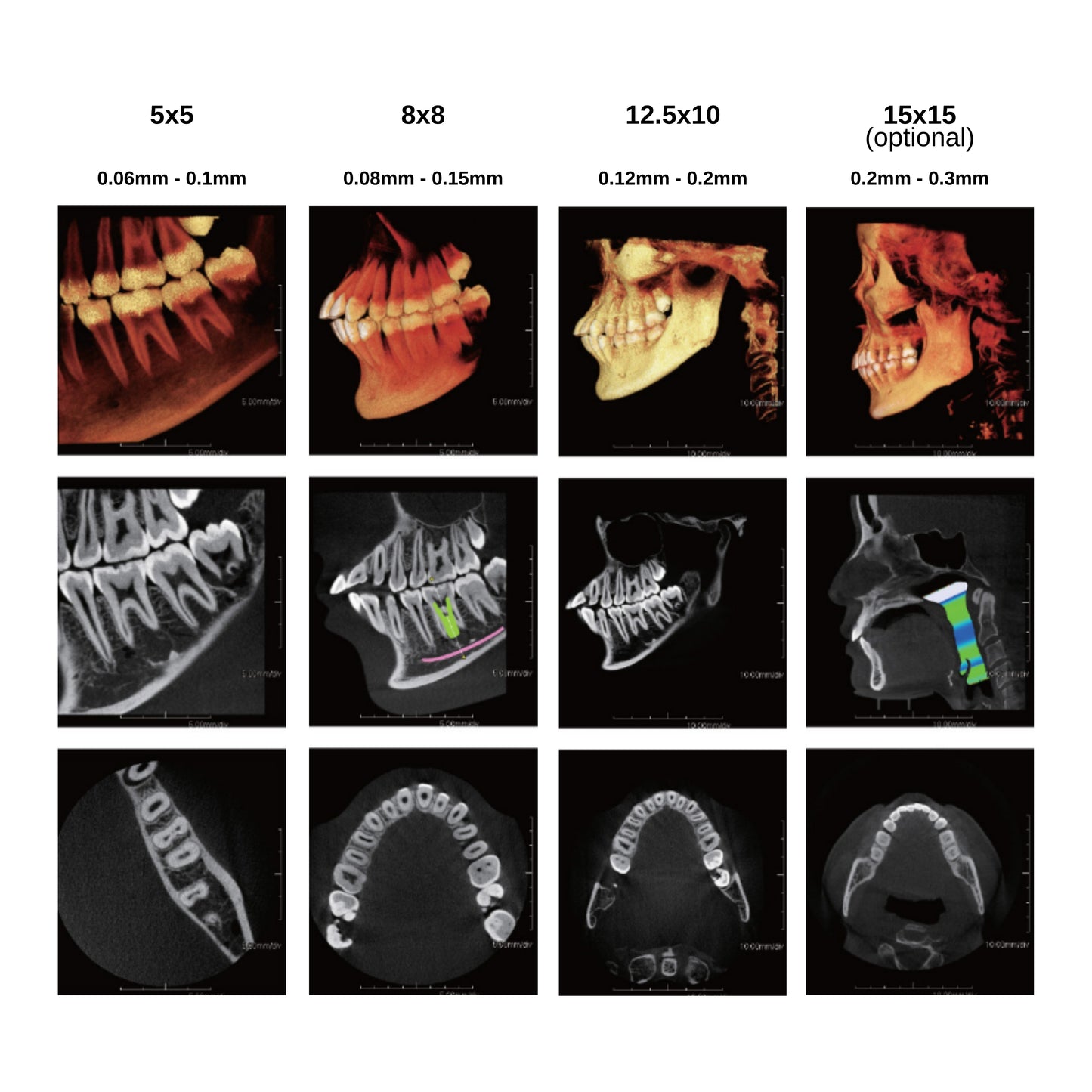 Prexion | 3D Expedition CBCT