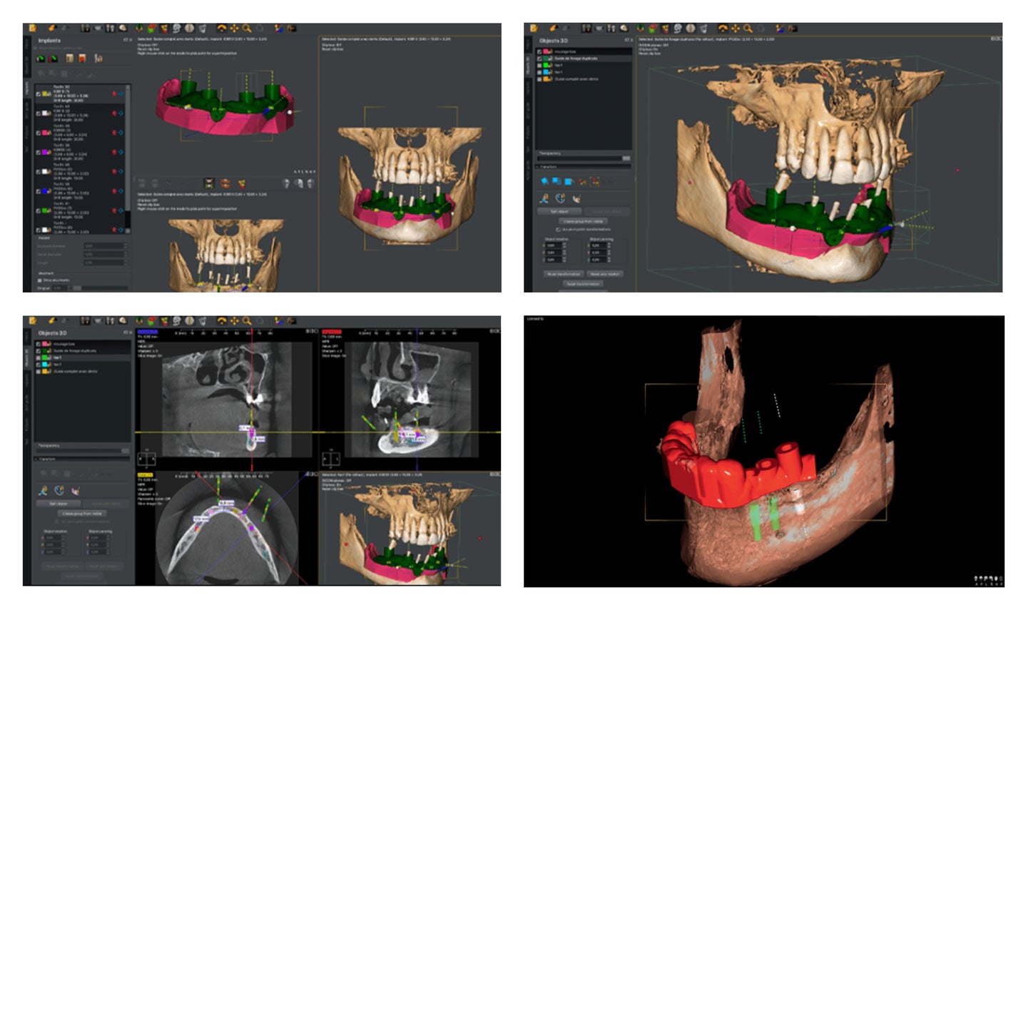 Owandy | I-Max 3D Pro