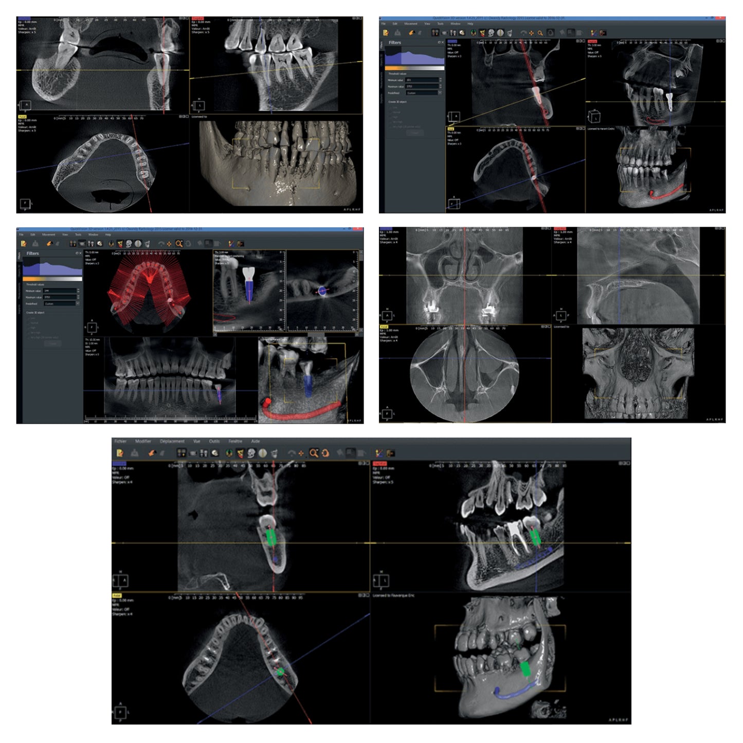 Owandy | I-Max 3D Pro