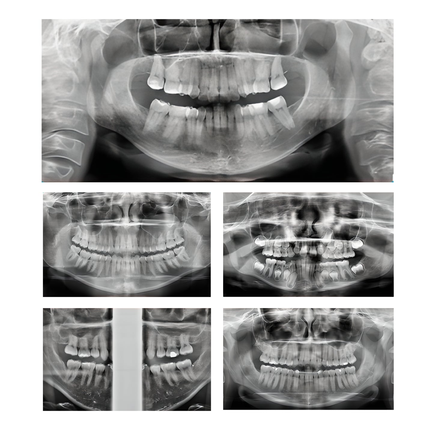 Dabi Atlante | Eagle Edge CBCT