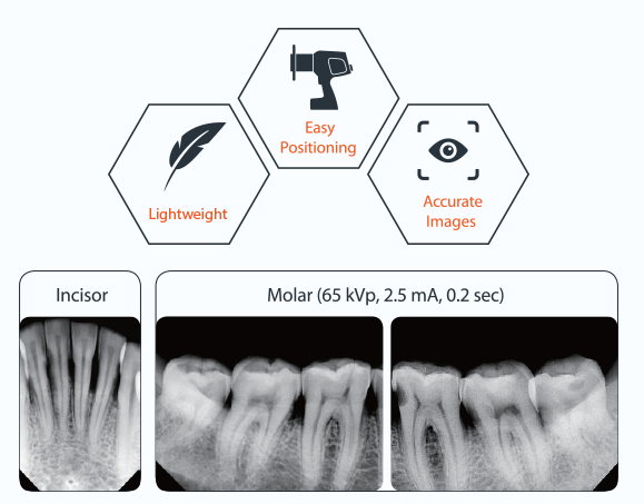 VATECH | EzRay Air P Portable X-ray