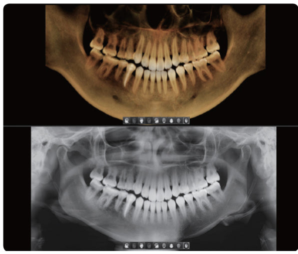 Vatech | Smart Plus CBCT