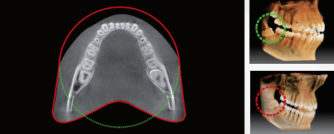 Vatech | Smart Plus CBCT