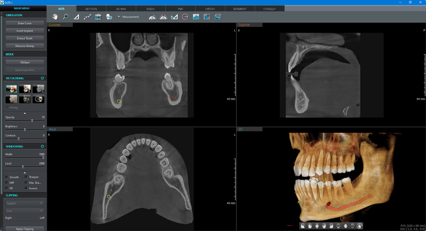 Vatech | Smart Plus CBCT