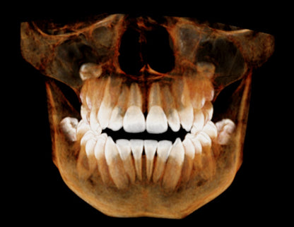 HDX WILL | Eco-X CBCT