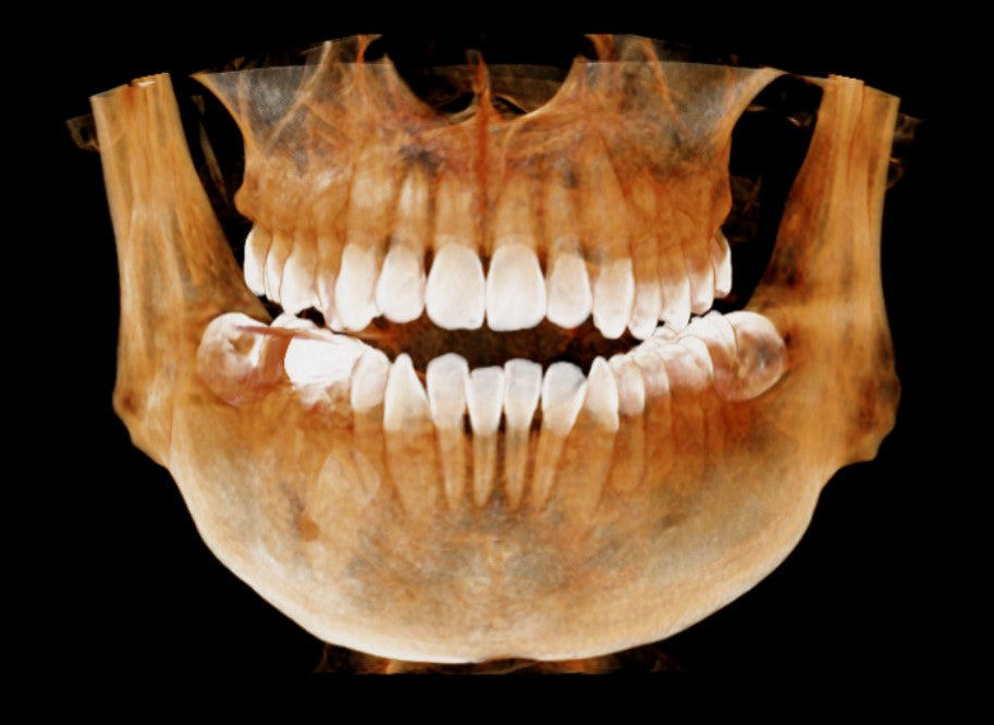 HDX WILL | Eco-X CBCT