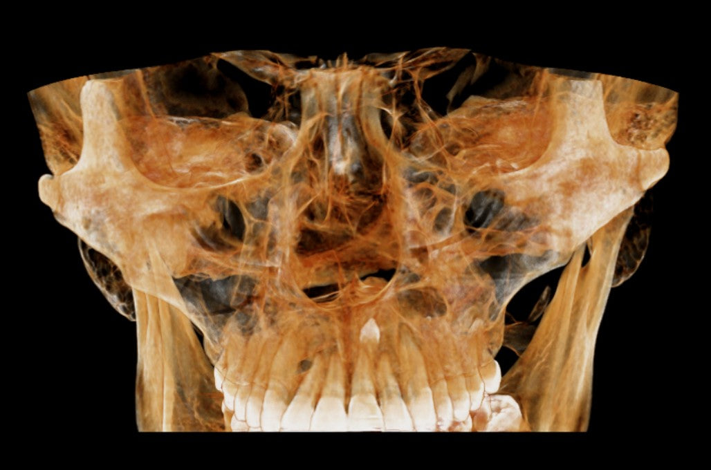 HDX WILL | Eco-X CBCT