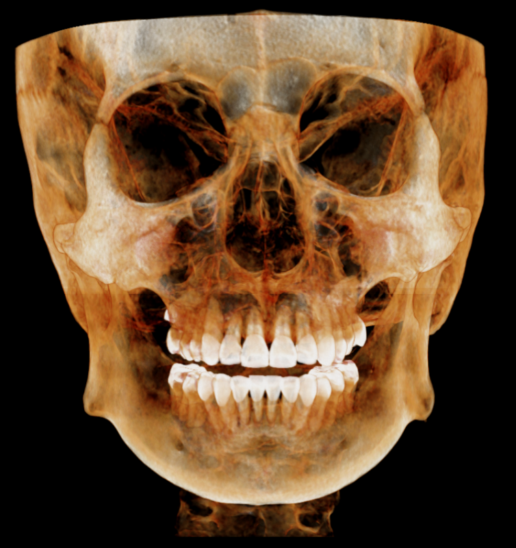 HDX WILL | Dentri MAX CBCT