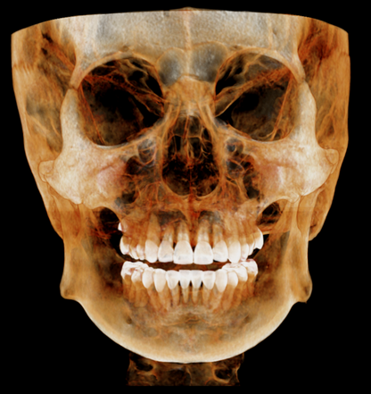 HDX WILL | Dentri MAX CBCT