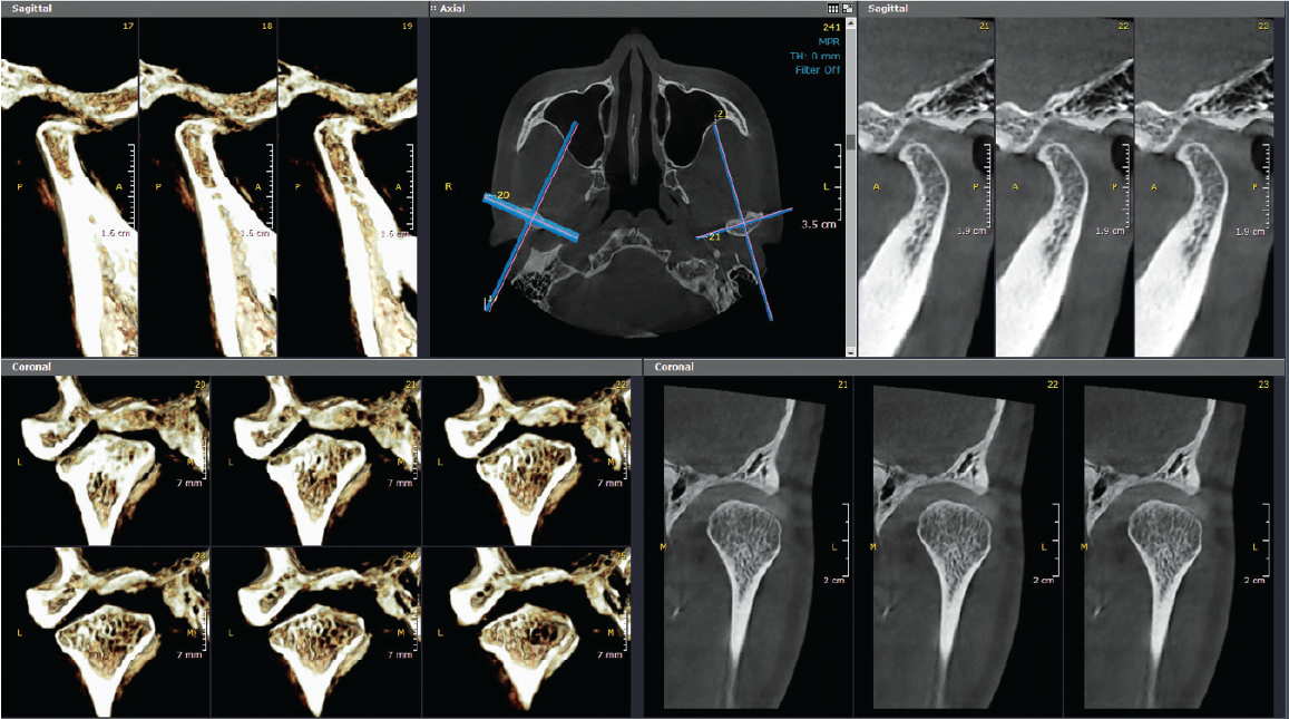 HDX WILL | Dentri MAX CBCT