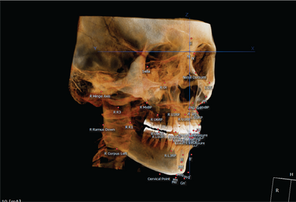 HDX WILL | Dentri MAX CBCT