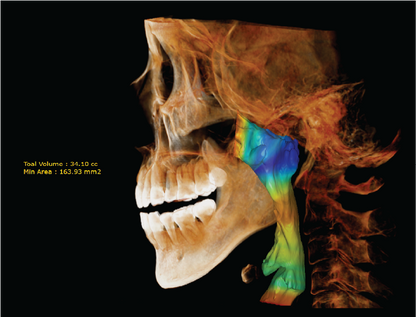 HDX WILL | Dentri MAX CBCT