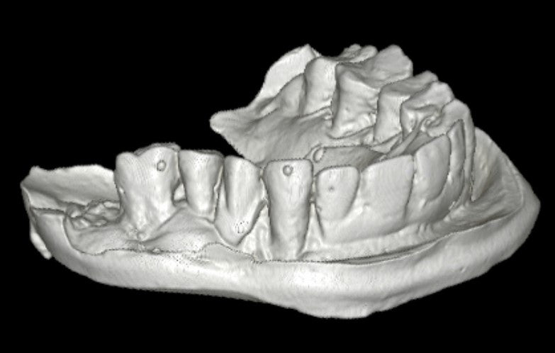 HDX WILL | Eco-X CBCT