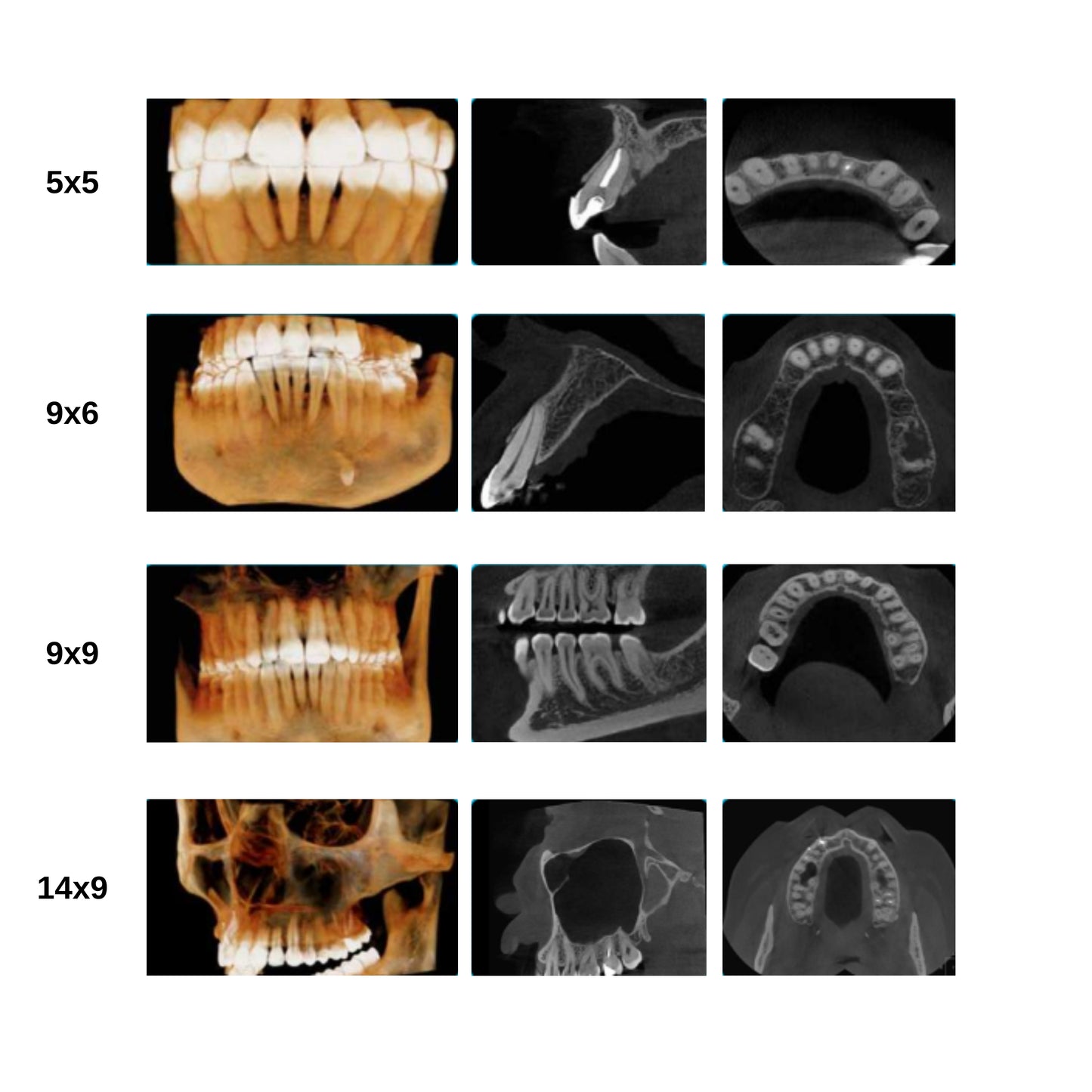 Dabi Atlante | Eagle Edge 0.2FS CBCT